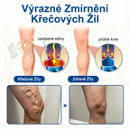 FLORISMA® Klinická mikrojehličková náplast s diosminem a hesperidinem🌿 – zaměřená na křečové a metličkové žilky, pomáhá zmírnit pocit těžkých a unavených nohou