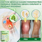 Oficiální český obchod | GeeLemon® 8v1 Nanomikrojehlicové náplasti na formování těla 🇨🇿 Pouze 1 použití denně ✅ Výsledky viditelné již za 7 dní – vhodné pro obezitu, kardiovaskulární zdraví, cukrovku a problémy s klouby