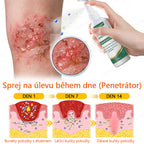 COLTURE® Systém pro denní a noční péči o ekzémy – dvojbalení bez steroidů pro úlevu od intenzivního svědění, zarudnutí a porušené pokožky (akční nabídka)
