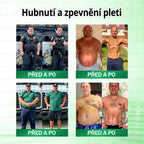 Oficiální český obchod | GeeLemon® 8v1 Nanomikrojehlicové náplasti na formování těla 🇨🇿 Pouze 1 použití denně ✅ Výsledky viditelné již za 7 dní – vhodné pro obezitu, kardiovaskulární zdraví, cukrovku a problémy s klouby