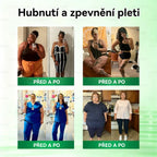 Oficiální obchod  |👩‍⚕️𝗟𝘂𝘅𝗮𝗿𝗶𝘀𝗲® MORINGA X BERBERIN  10-IN-1 Pokročilý Nano Mikrojehly Náplast(Jedna náplast denně, viditelné změny již za 7 dní) ✅ Pomáhá při obezitě, cukrovce, spánkové apnoe, problémech s klouby a dalších potížích🌺