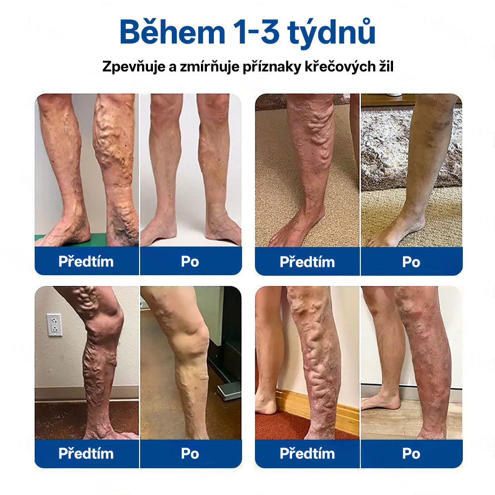 GFOUK® VeinTarget Microneedle Patch |⚡ Okamžitá úleva, dlouhodobé výsledky