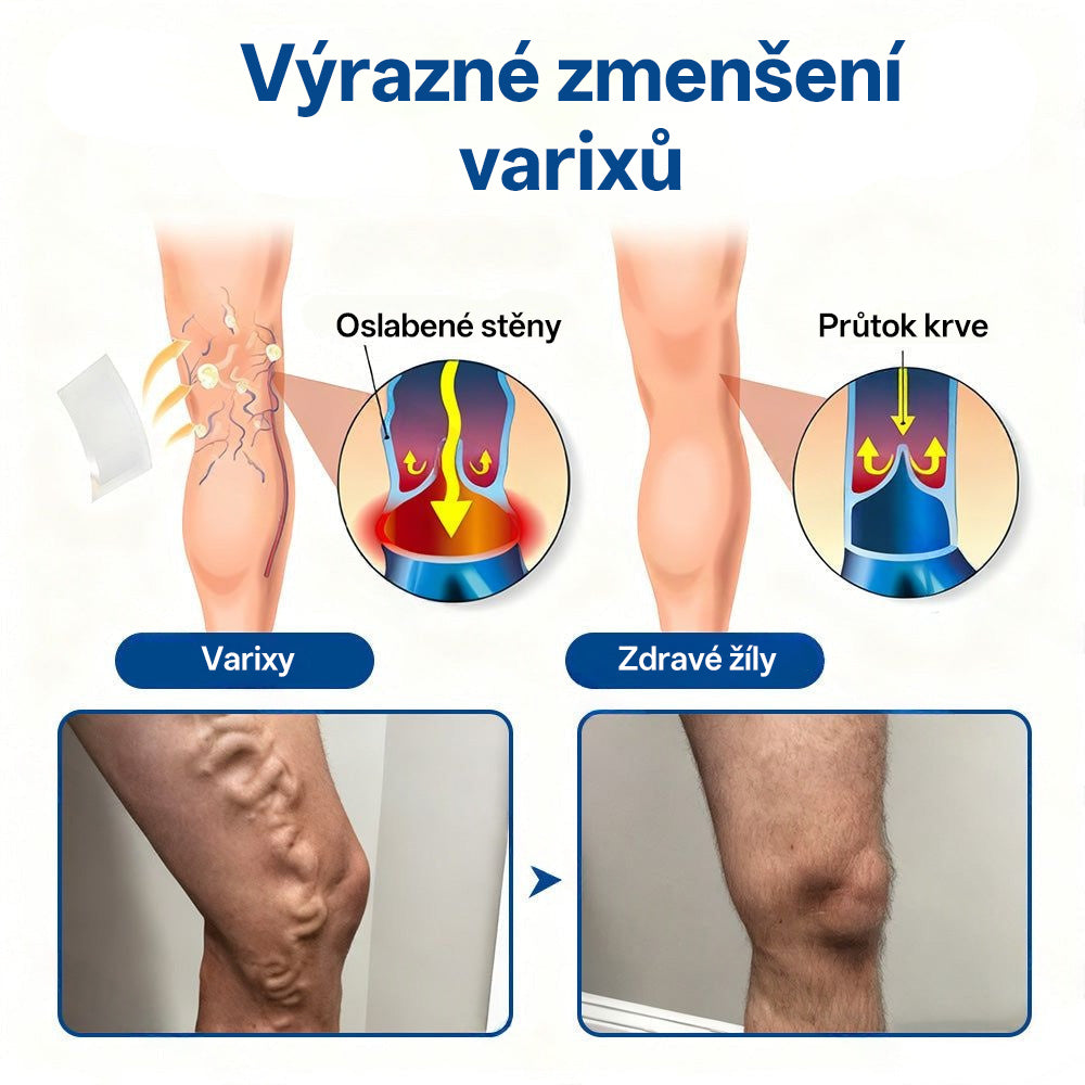 GFOUK® VeinTarget Microneedle Patch |⚡ Okamžitá úleva, dlouhodobé výsledky