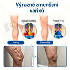 GFOUK® VeinTarget Microneedle Patch |⚡ Okamžitá úleva, dlouhodobé výsledky